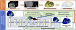 Embedding High-dimensional Bayesian Optimization via Generative Modeling - Parameter Personalization of Cardiac Electrophysiological Models