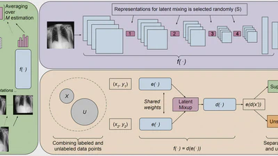 Semi-supervised Medical Image Classification with Global Latent Mixing featured image